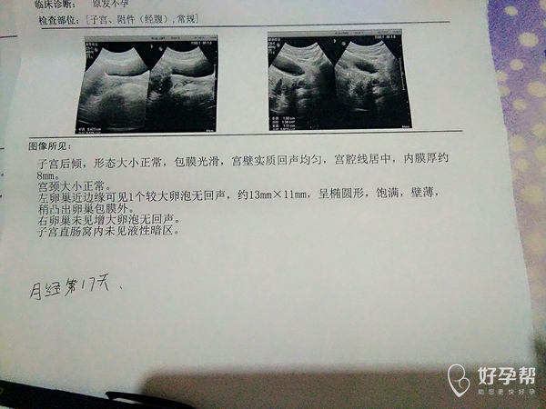 什么时候检查内膜厚度最合适 gw-topic