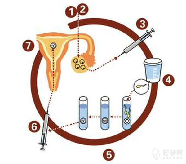 【试管圈话题】移植压力太大?你是怎样缓解压力的?