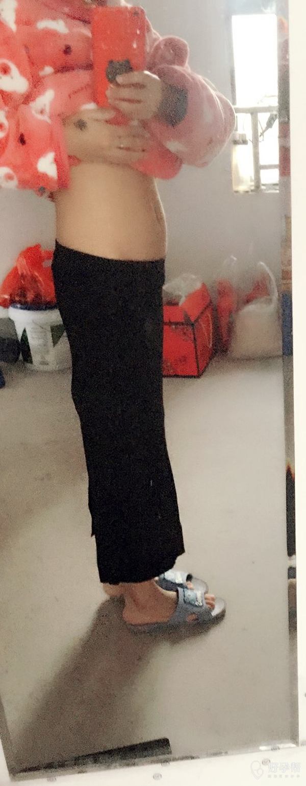 18周多了,肚子还是这样的