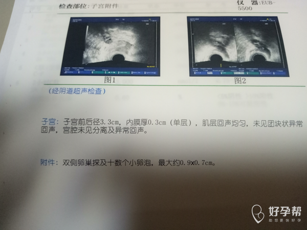 中药怎么调理多囊 gw-topic