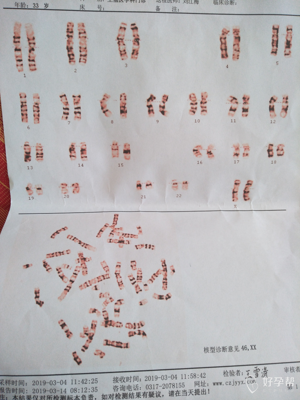 染色体检验报告在线的医生帮忙看一下有没有问题