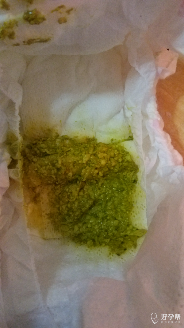 每次里面都有豆瓣状的颗粒,医生帮忙看看这大便正常吗?