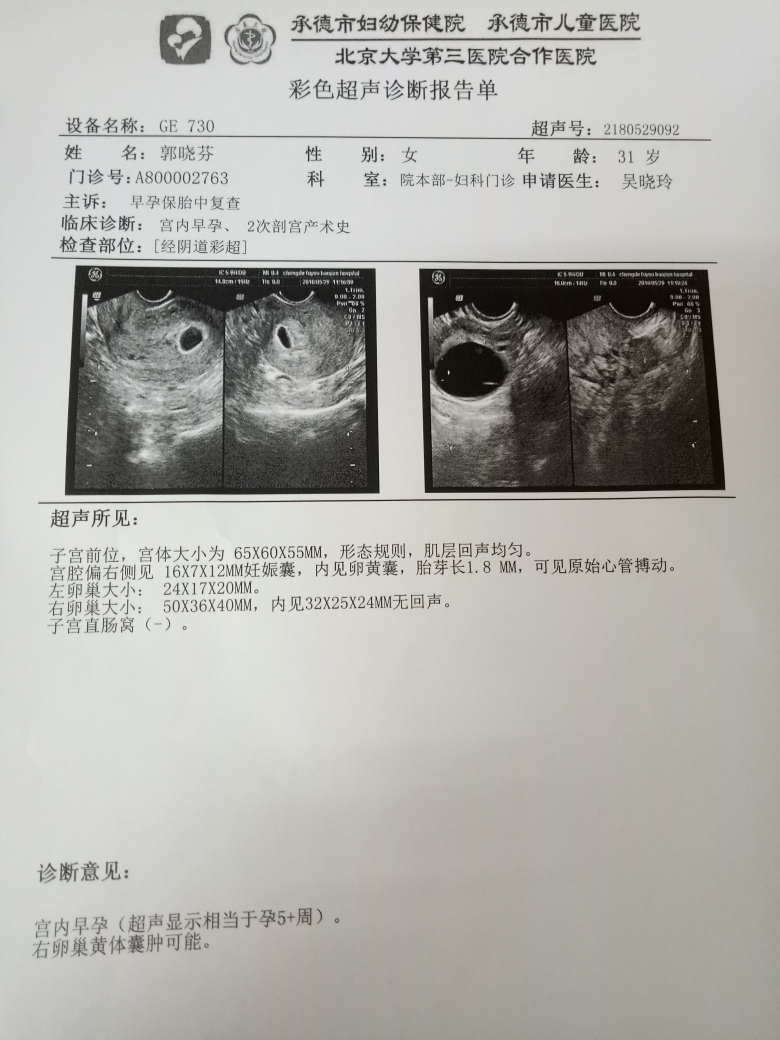 55天男孩孕囊图片图片