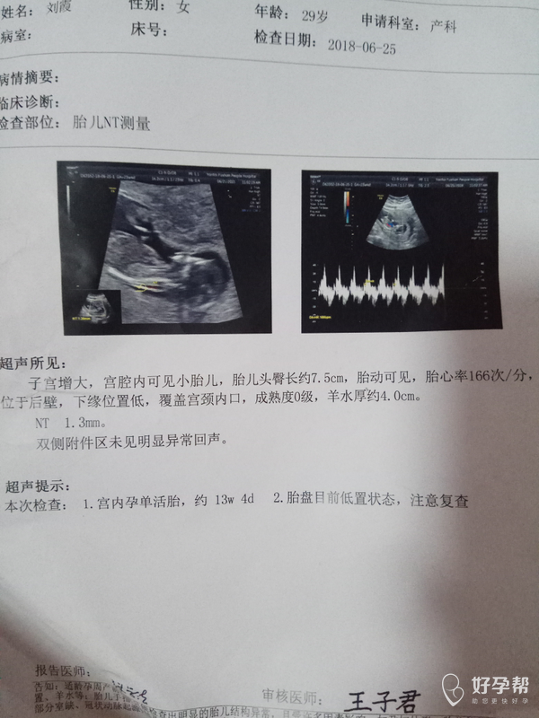 胎心强的是男孩女孩[疑问]这个能看出来吗? -好孕妈妈圈-好孕帮