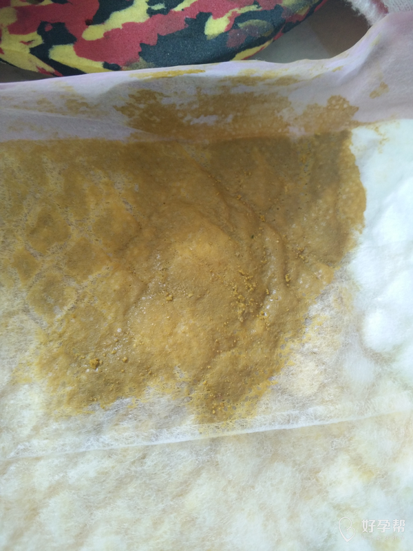 医生帮忙看一下我家宝宝是坏肚子还是消化不良