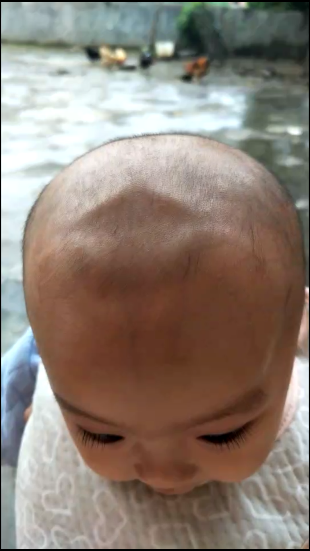 婴幼儿方颅症状照片图片