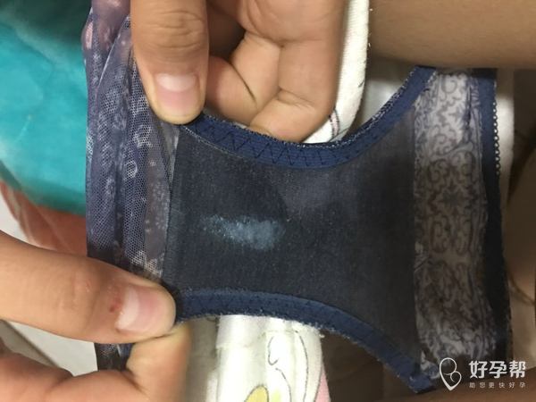 急急急急,求医生帮忙看一下什么情况?