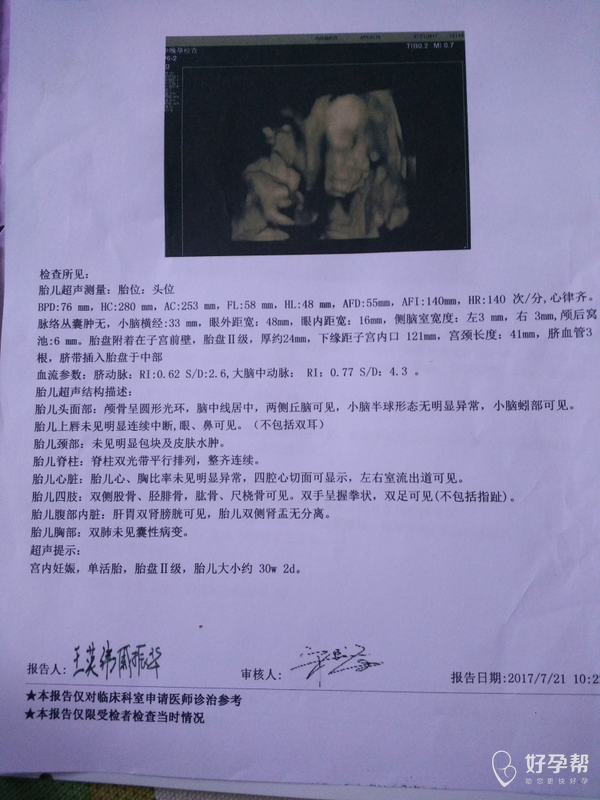 几个月做四维看得最清楚 gw-topic