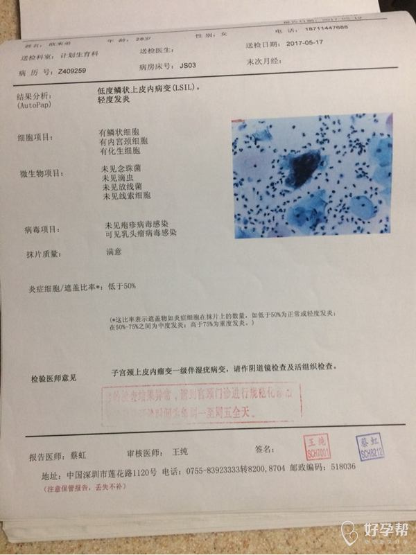 子宫内膜异位症-备孕交流论坛-好孕帮