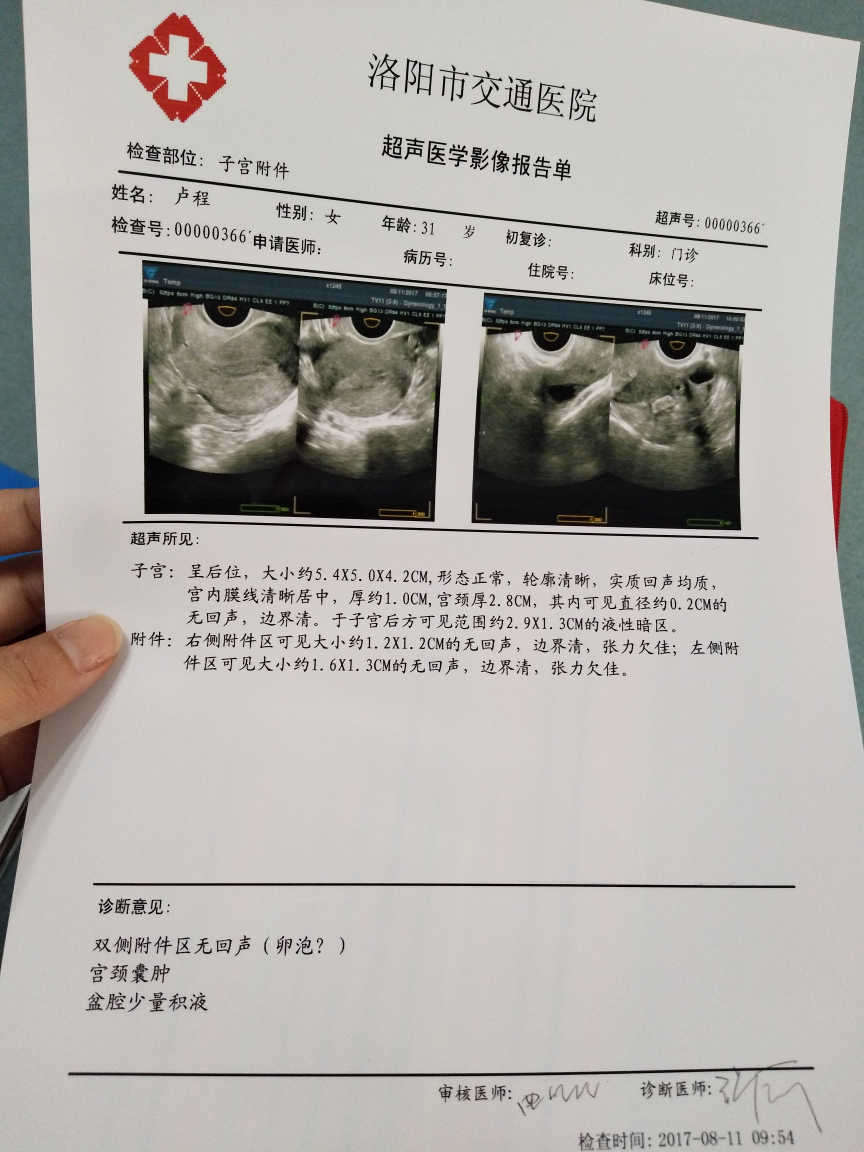 卵巢囊肿彩超单子图片图片