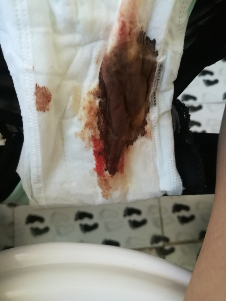 卫生巾带血黏液图片