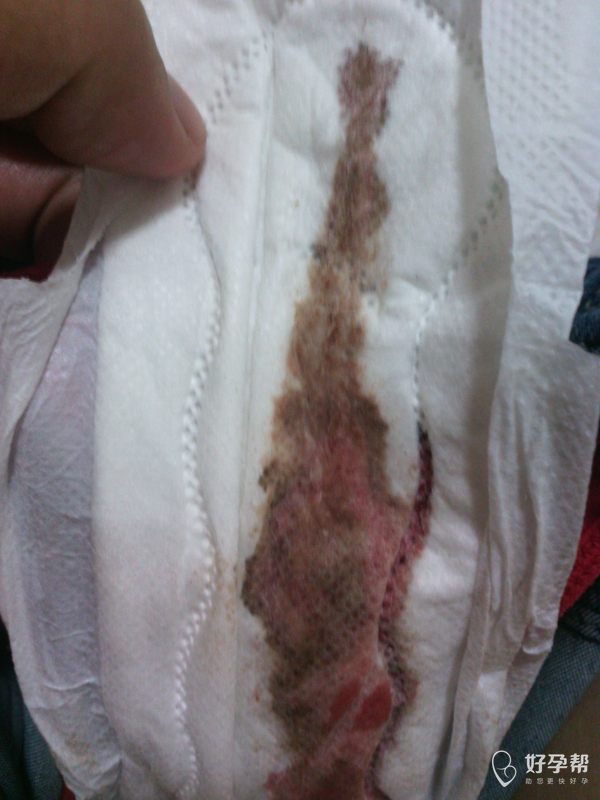 平阴县中医院你好,月经不正常,需要平时避免受凉,可以用中药调理