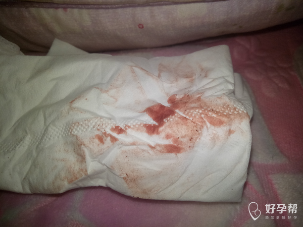 《昨晚上用水洗了下阴道,用手指头勾出来一点点血块