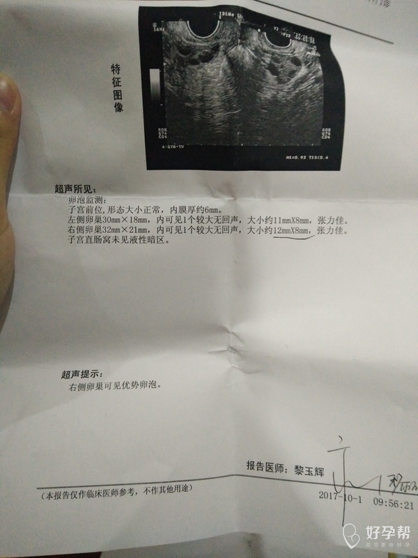 检监测的卵泡结果,这是怎么回事?