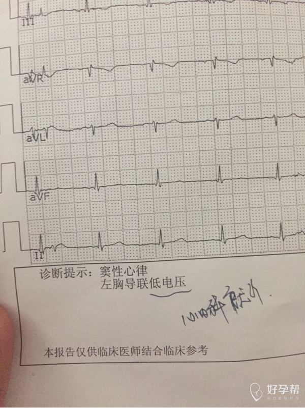 懷孕10周了,心電圖說我左胸導聯低電壓是什麼意思