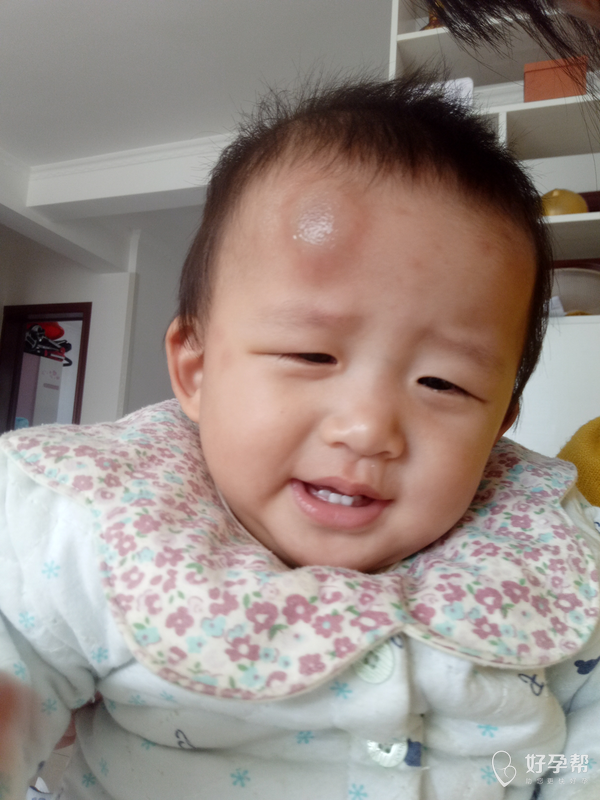 后果把她头摔的抱起来就一个大包