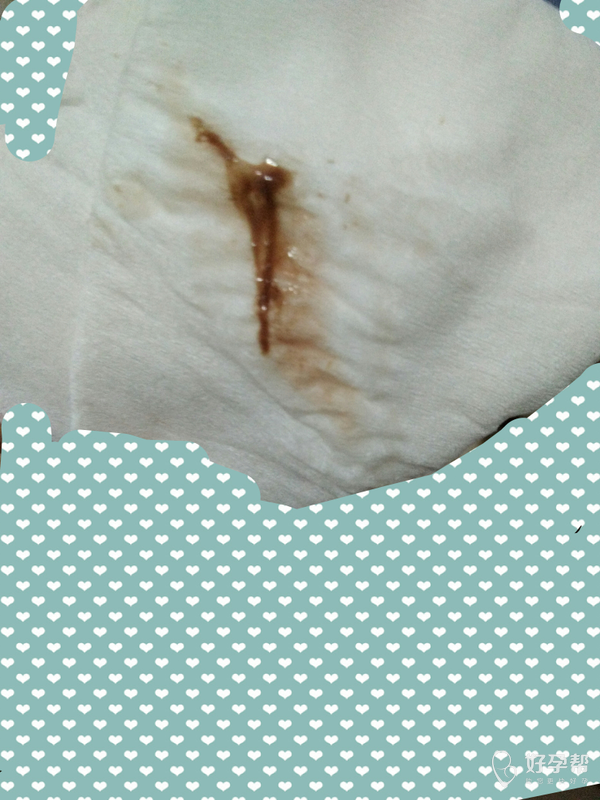 这是生化了?还是着床呢