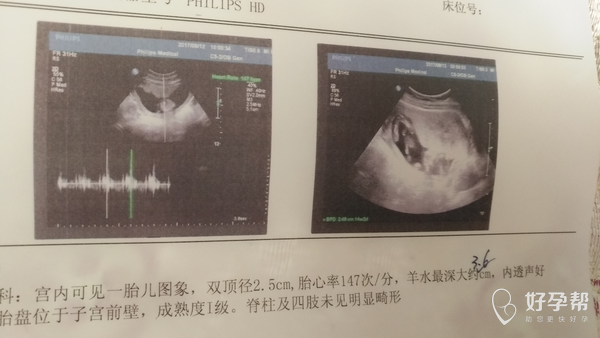 15025153343884.jpg@!gw-topic