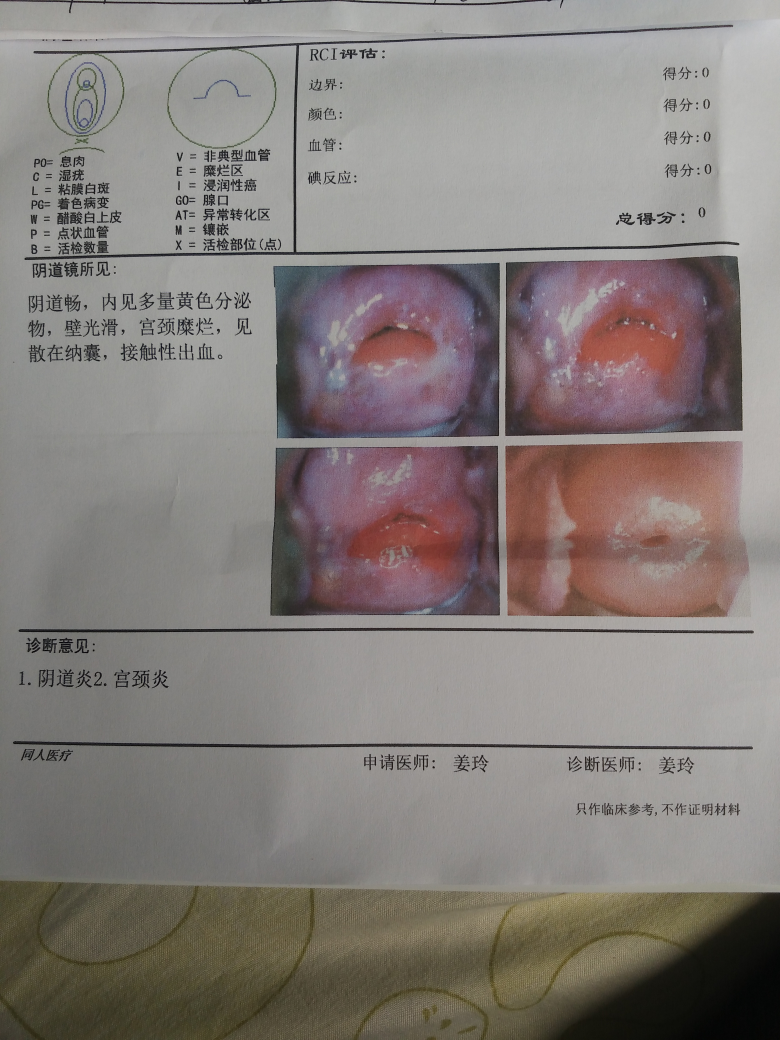 今早刚检查的结果