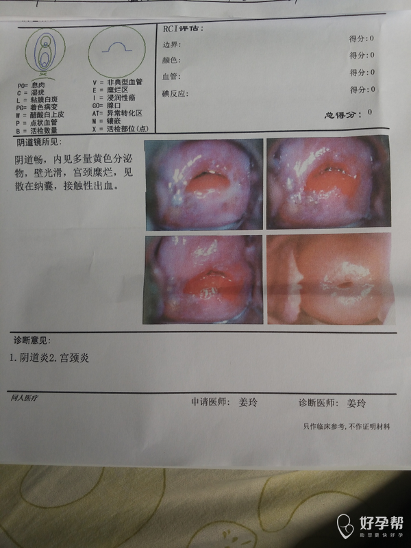 备孕心情-宫颈糜烂-月经推迟-备孕交流论坛-好孕帮