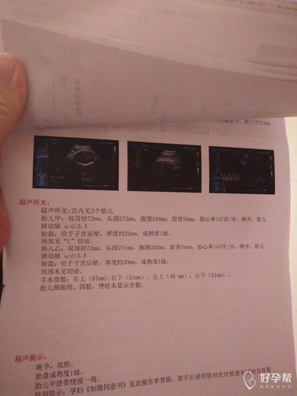 怀孕33周 想知道胎儿大小是不是正常 大概在多少斤左右