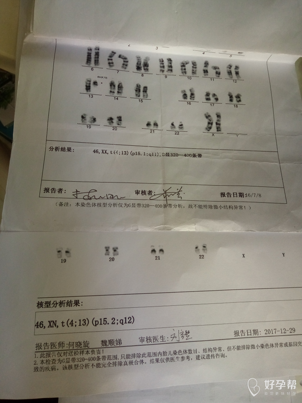 上面报告单是我没怀孕前自己的,下面这个是羊水穿刺的.