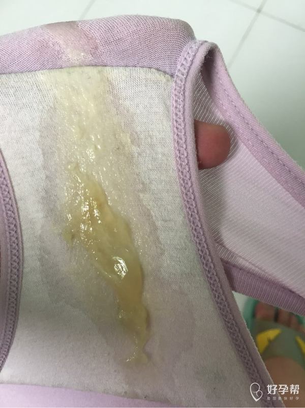 明天预产期 刚刚有一块果冻样的分泌物出来 是要生了吗 二胎