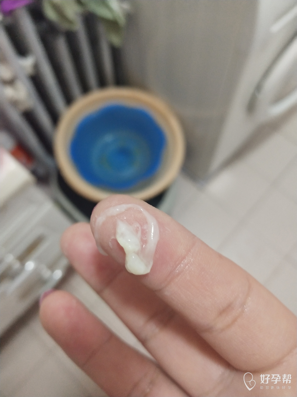 求助谁知道这是什么哪位好心的医生或白衣天使能帮我解答啊