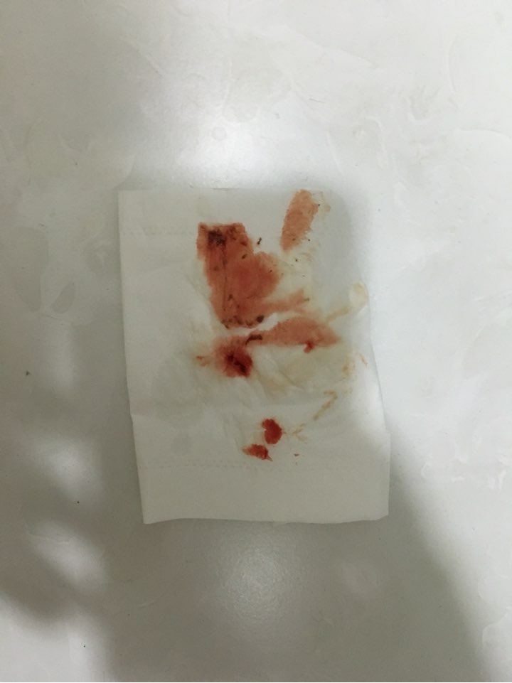 纸巾流血照片图片