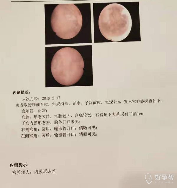 gw-topic
