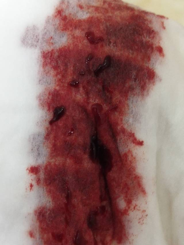 月经血稀像血水图片图片