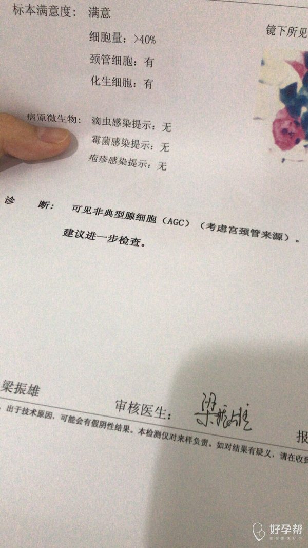 年齡22去年做過hpv陰性這次沒做做了tct