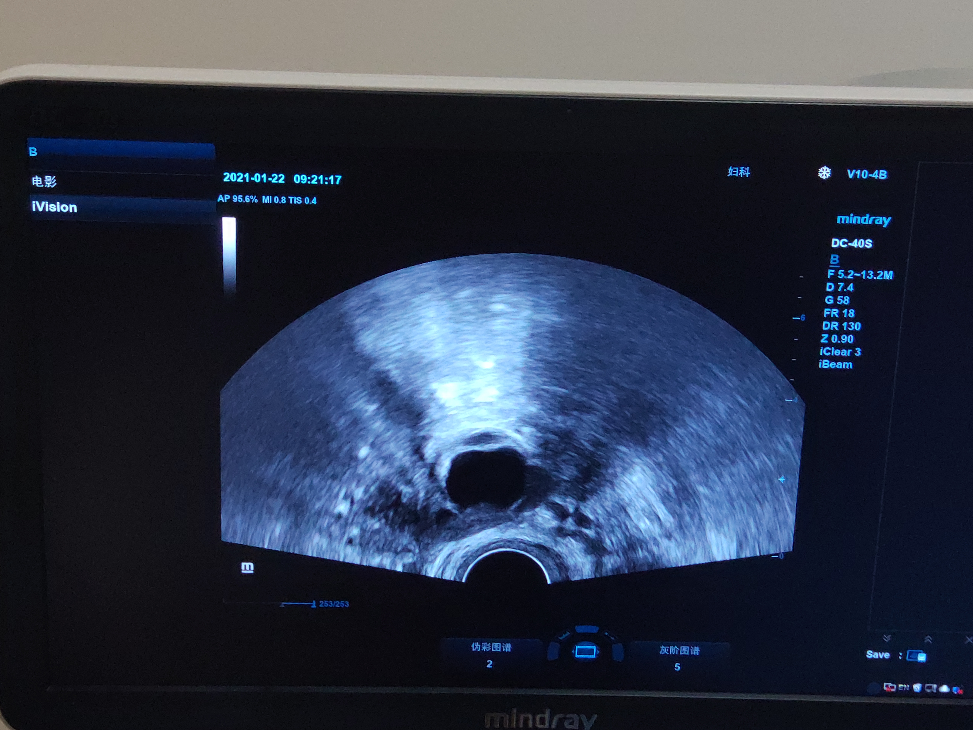 1月22早上9点去监测卵泡做得阴超医生操作过