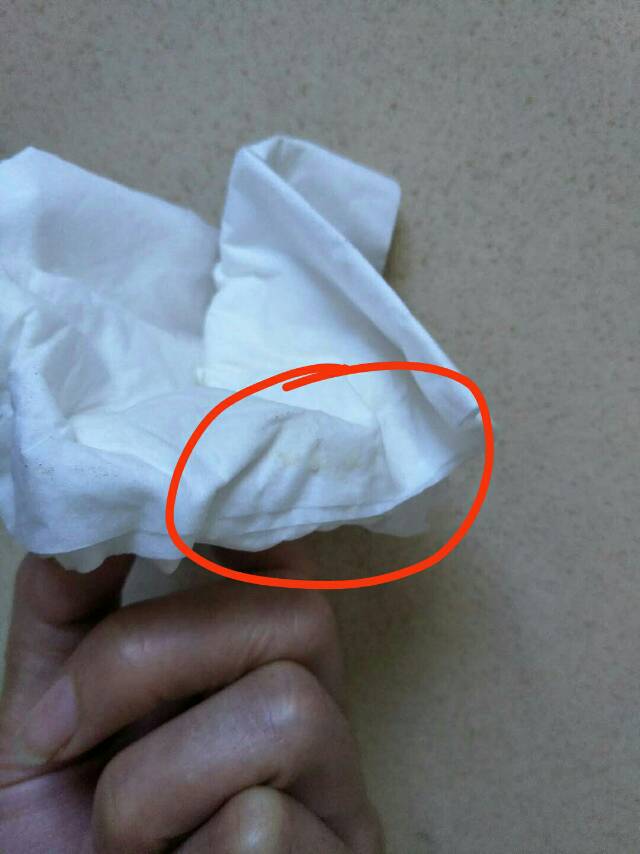 我现在是黄体期后期快来例假了之前来例假的时候