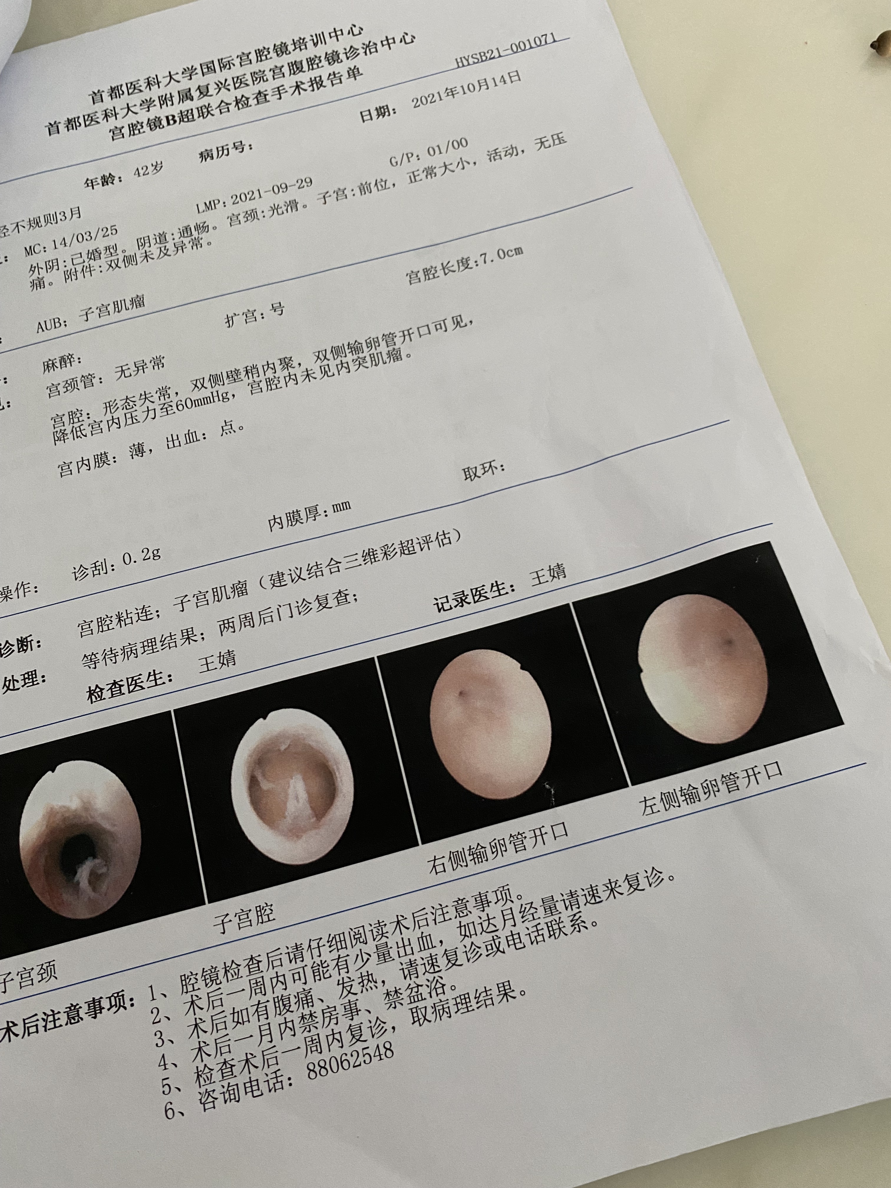 宮腔鏡檢查發現是宮腔粘連經三維彩超確診同時提-試管嬰兒圈-好孕幫