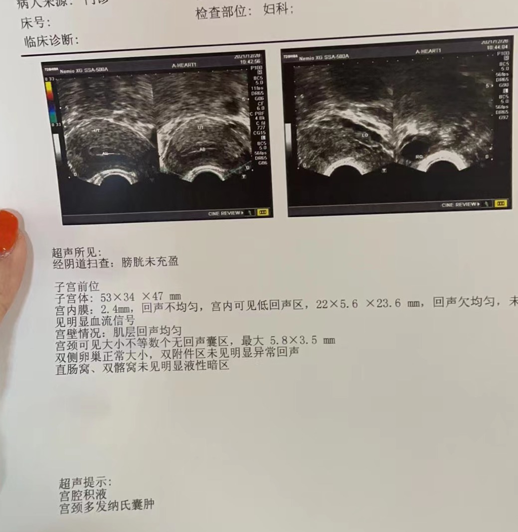 上次月經剛開完15天以後又來了不清楚是什麼情-備孕交流圈-好孕幫