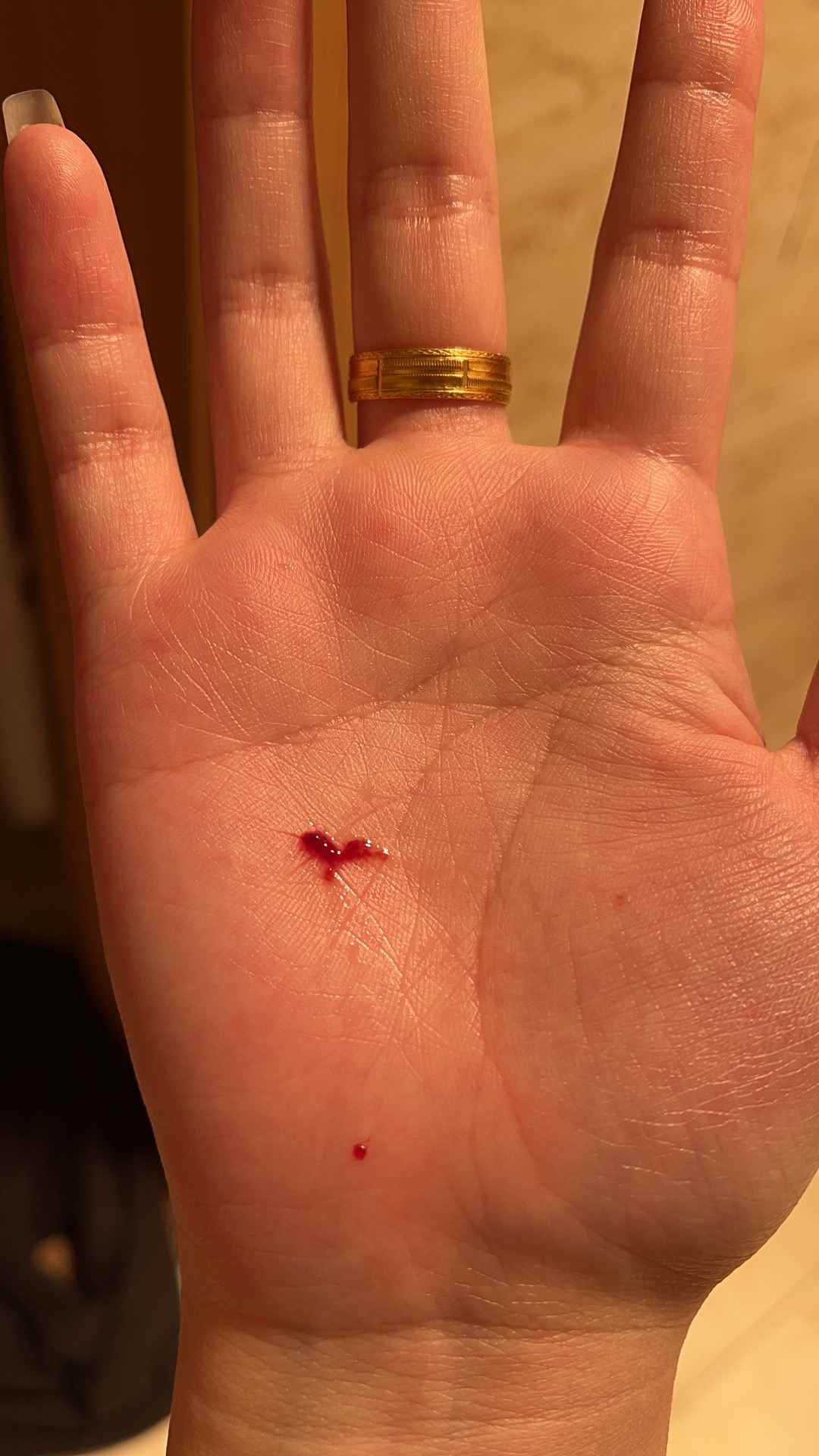 怀孕13周咳嗽有血鼻涕有血