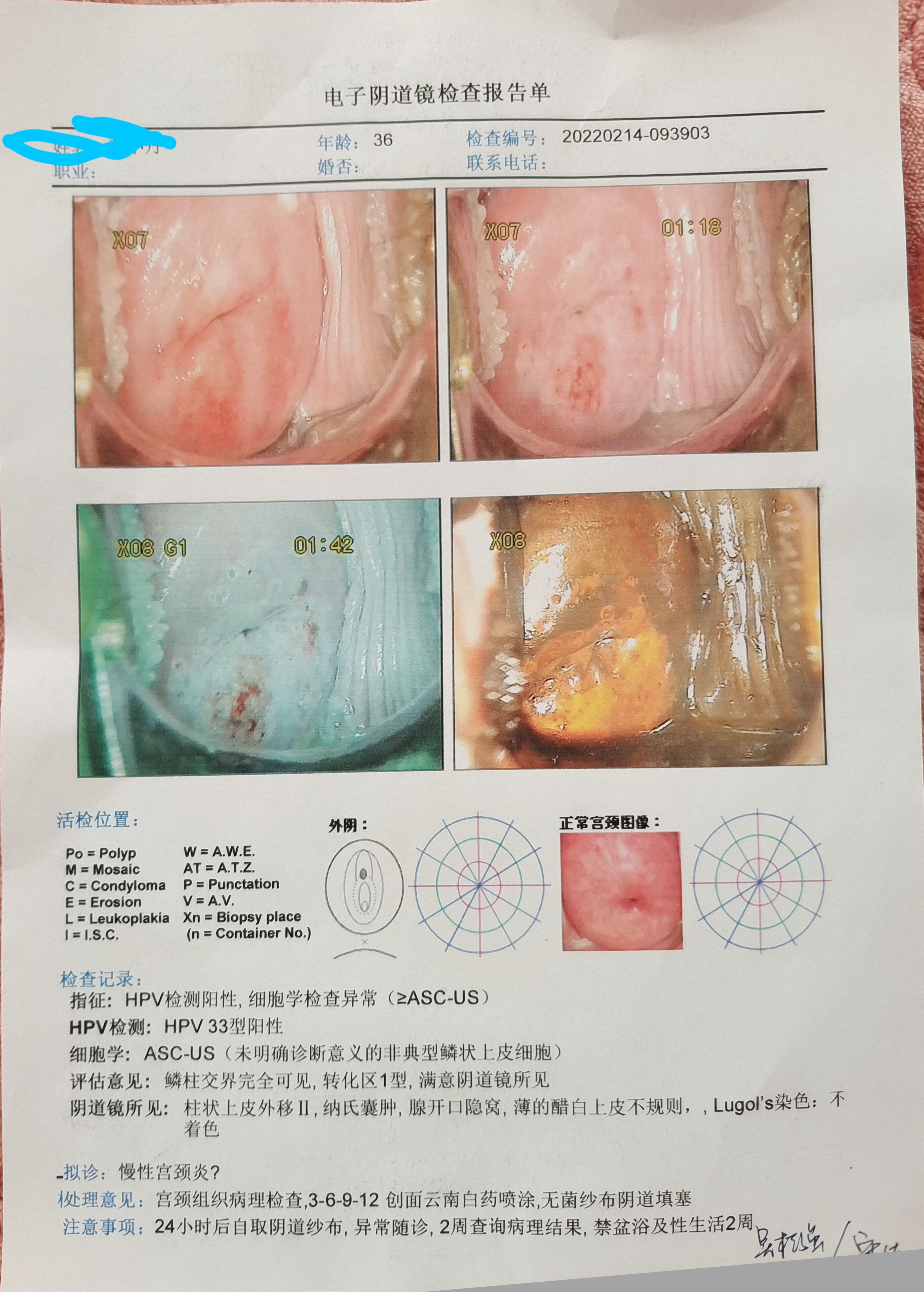 阴超镜检查疼吗图片